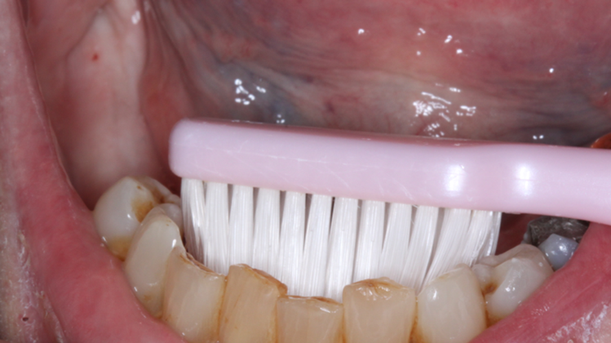 En traditionel tandbørste.